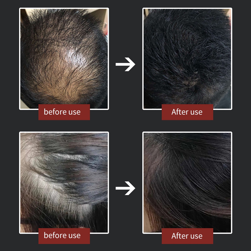 (Dark Brown) Toppik Hair Building Fibres Keratin Thickening Spray