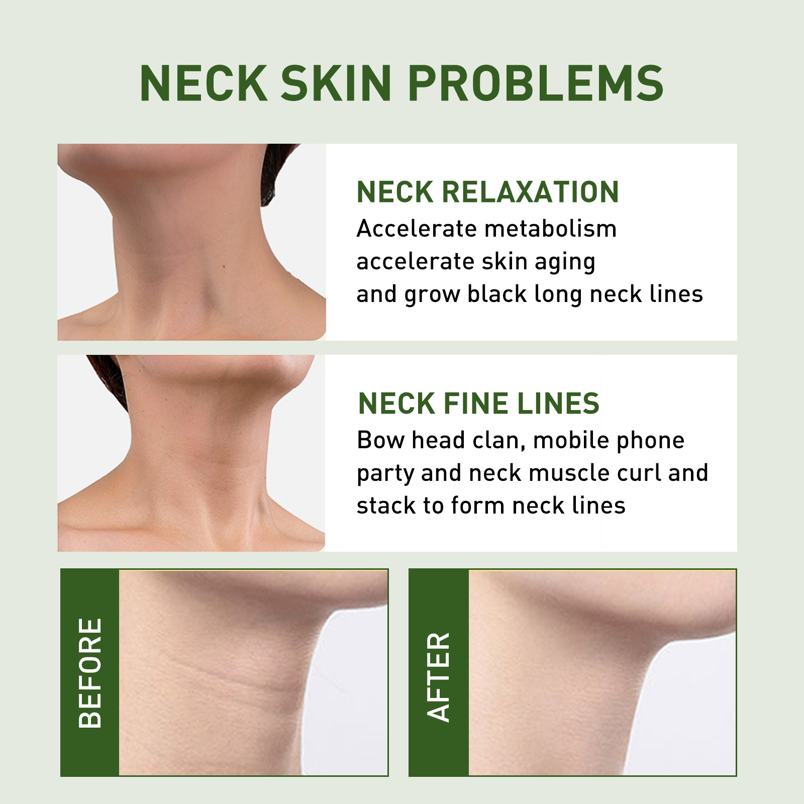 Neck Cream Neck Skin Firming Tightening Cream Neck Line Lifting Essence Moisturizing Cream Repairs Dullness  Dark Neck Lines Gone Face Skin Care