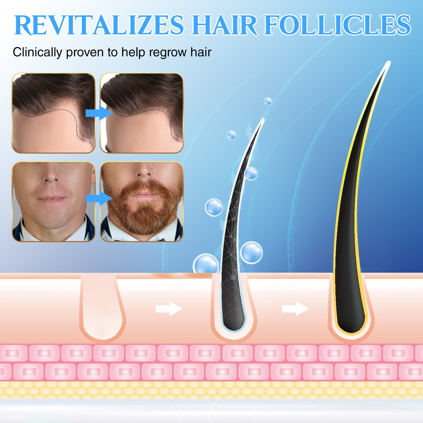 Hair Growth Spray Hair Serum For Men And Women Hair Oil Makes Hair Smoother Thicker Healthier Repair Baldness Thicken Strengthening Hair Loss Treatment 60ML