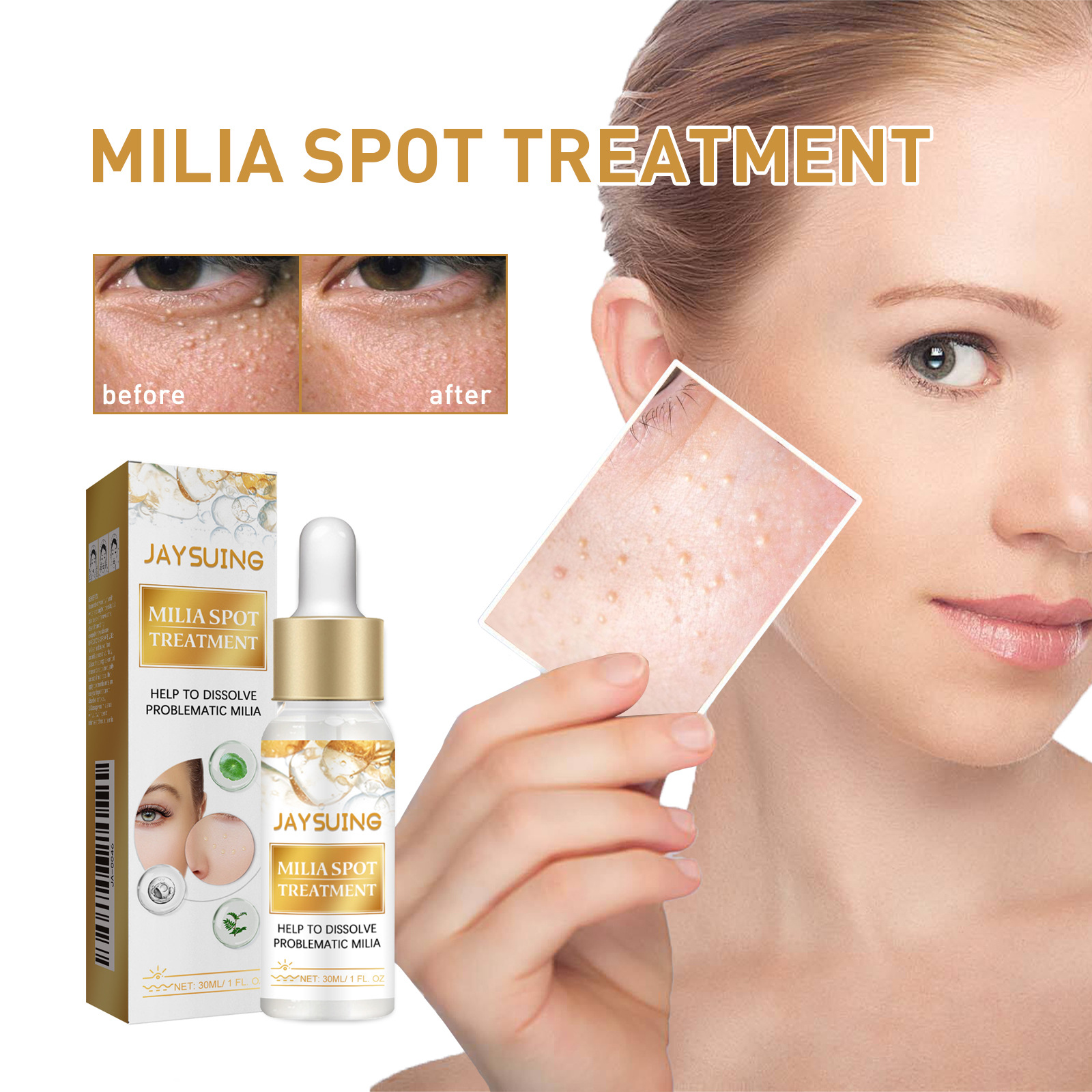 (1 PC) Fat Granules Removal Eye Serum Milia Spot Treatment Puffiness Repair Fine Lines Eye Bag Oil Control Moisturize Essence Eye Skin Soothing Remove Particles Around the Eyes