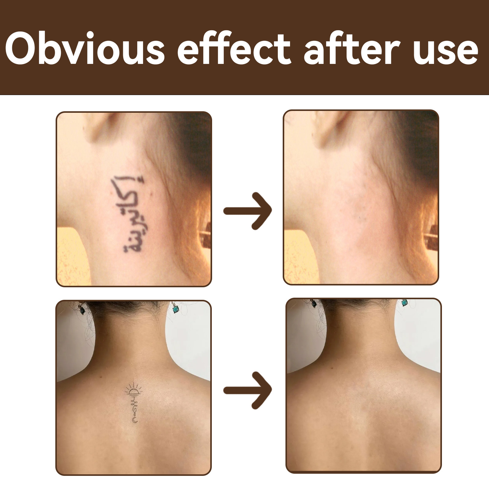 (1PC Light Color) Tattoo Concealer Invisible Tattoo Cover Cream Body Scars Birthmark Spots Covers Waterproof Brightening Makeup Cosmetics Tool Foundation Makeup 20g
