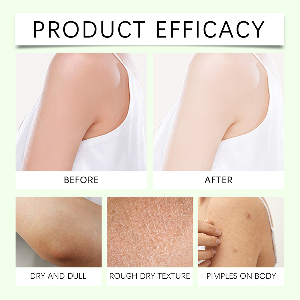 WOODSLEEP Body Moisturizer Butter Magnesium Cream Moisturizing Body Lotion Cream Restores Body Skin Care 114g