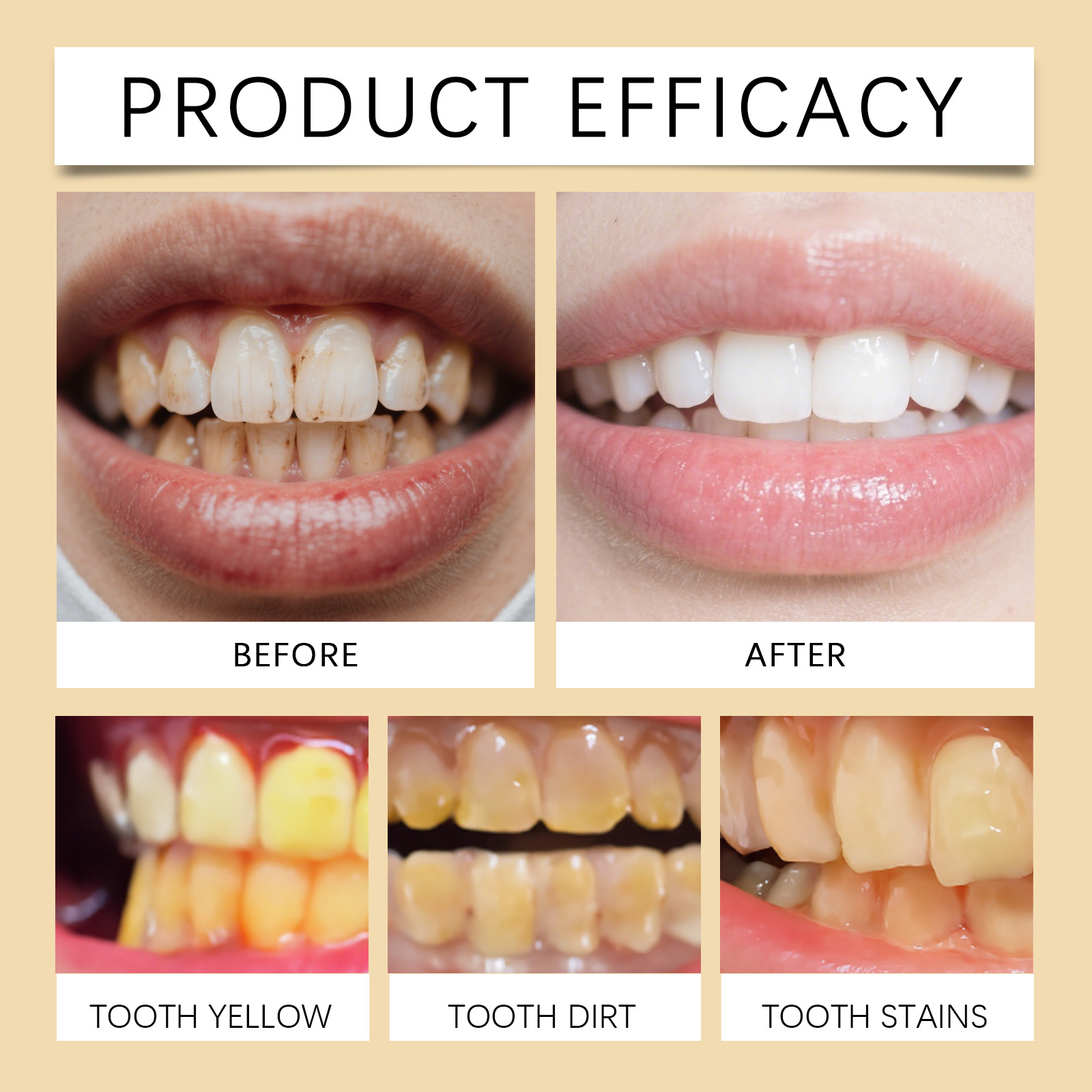 Bee Venom Cleansing Mousse Gentle Clean Protect Bright Teeth Press Type Design Daily Oral Care Tooth Paste