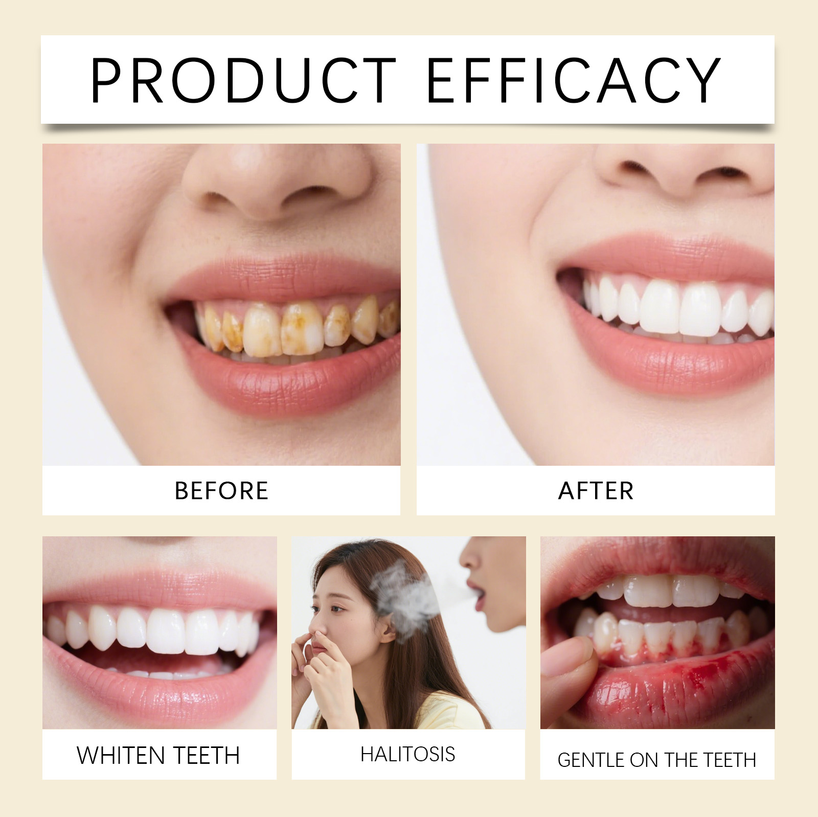 Mouthwash Gentle Formula Cleans Oral Cavity Guards Teeth Maintains Fresh Breath Daily Care