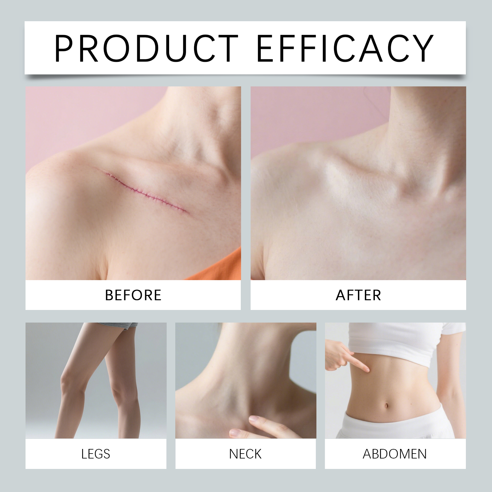 Skin Care Patch Mild Ingredient Protect Cover Improve Smooth Skin Look For Body Face