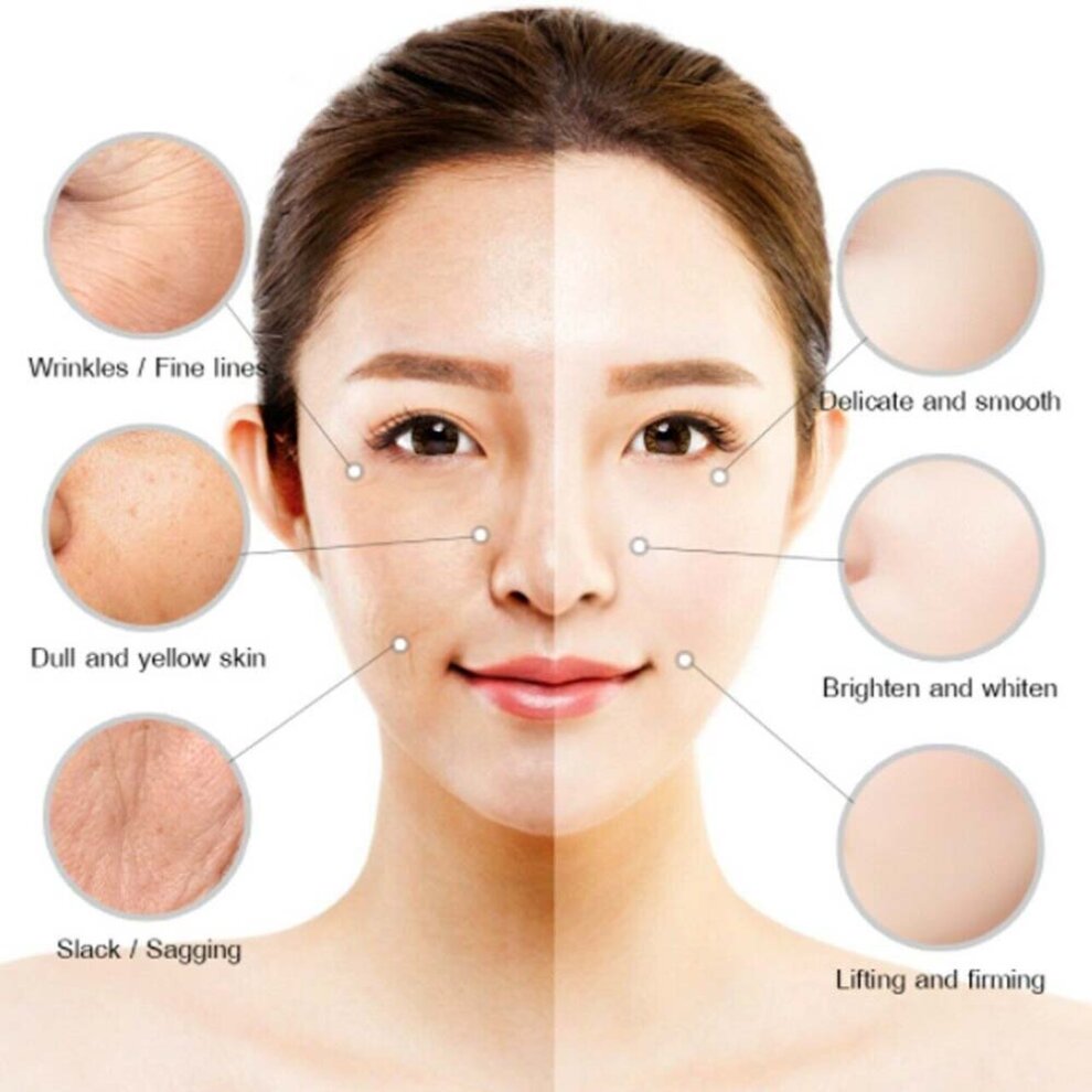 Whitening Cream Retinol Removes Melasma Acne Spots Pigment Dark Spots Pigment