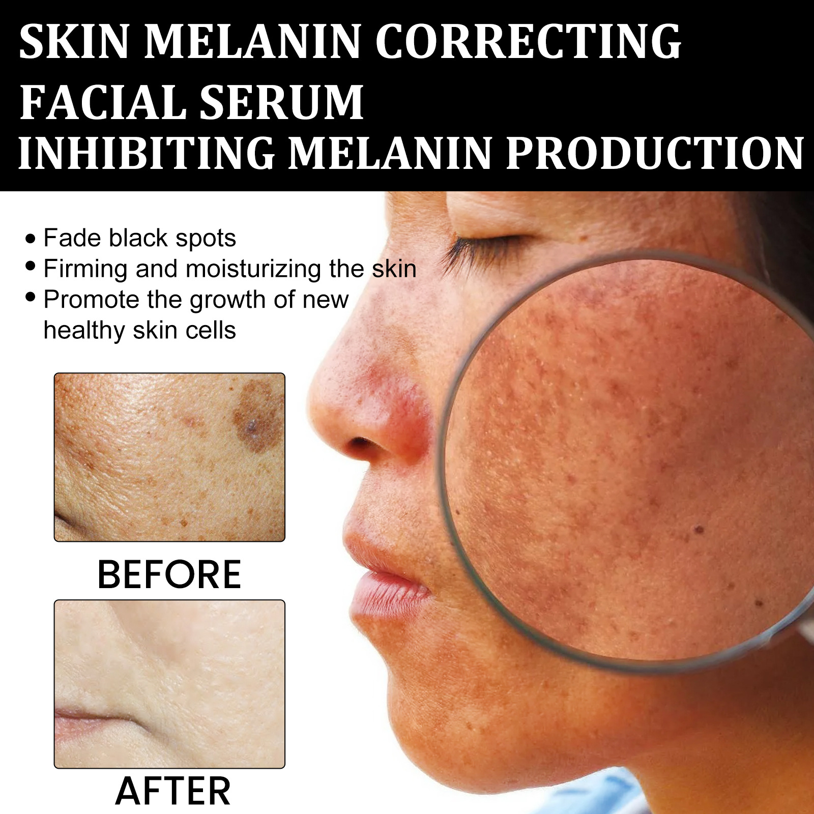 EELHOE Skin Melanin Correcting Serum Fade Dark Spots Anti Freckle Melasma Remover Dull Skin Nourish Lighten Pigment Blemish Glow Vitamin C Face Essence.