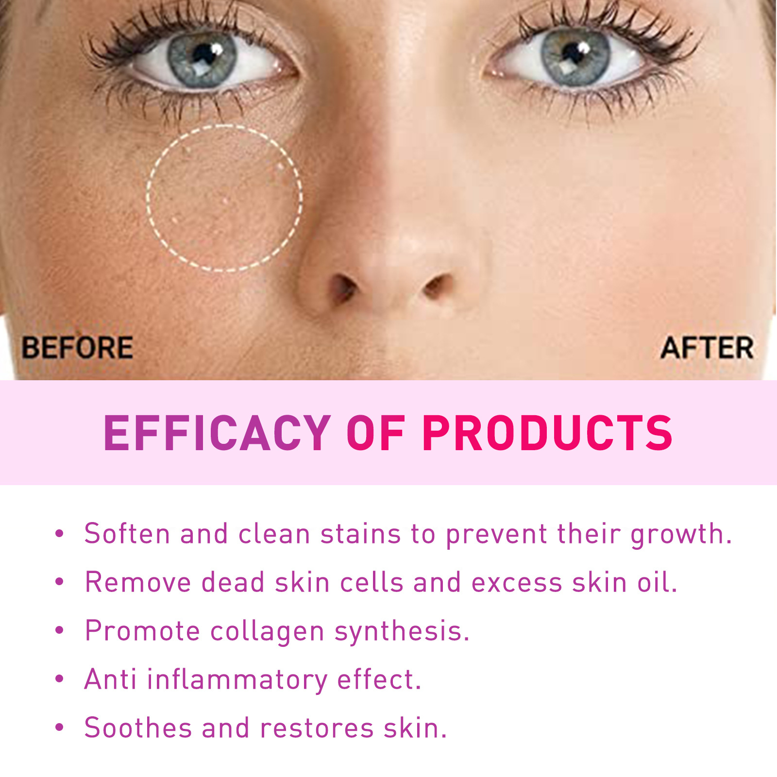 (1 PC) Fat Granules Removal Eye Serum Milia Spot Treatment Puffiness Repair Fine Lines Eye Bag Oil Control Moisturize Essence Eye Skin Soothing Remove Particles Around the Eyes
