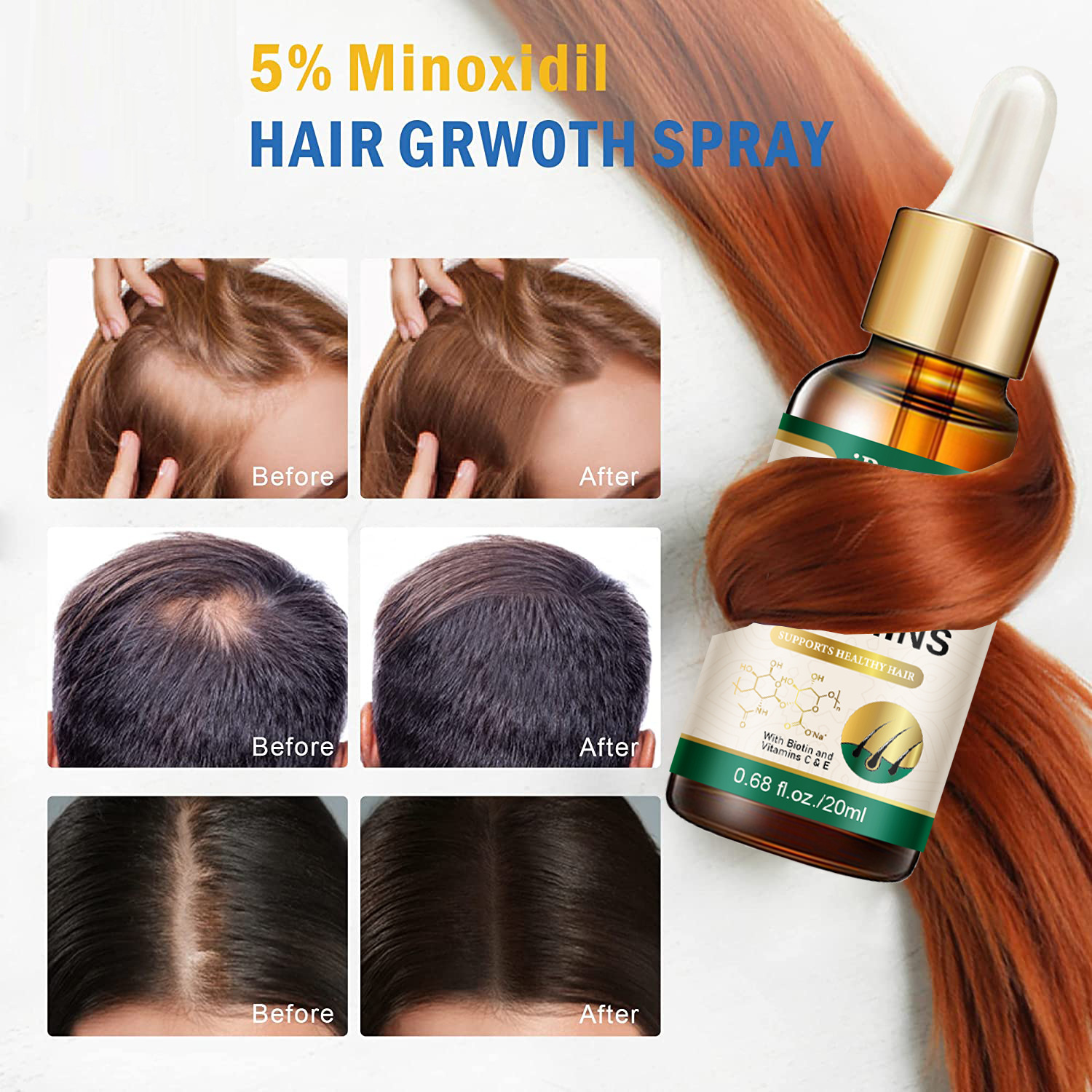 iBeaLee Hair Vitamin Hair Growth Serum Treatment Anti-Hair Loss Preventing For Thinning Hair Thickening Reawakening Beard Hair Care