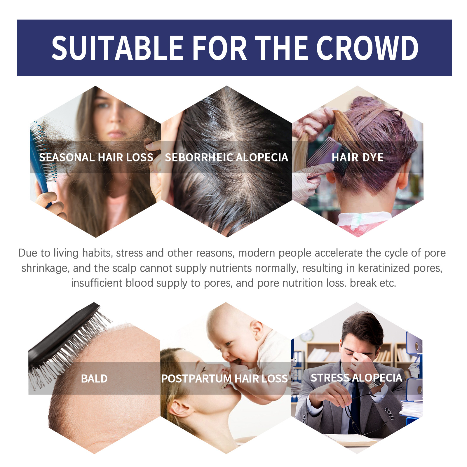 Hair Growth Serum Hair Growth Oil Anti-Hair Loss Nourishing Hair Roots Reapir Scalp Care Products Anti Thinning Hair Treatment Hair Regrowth Treatment