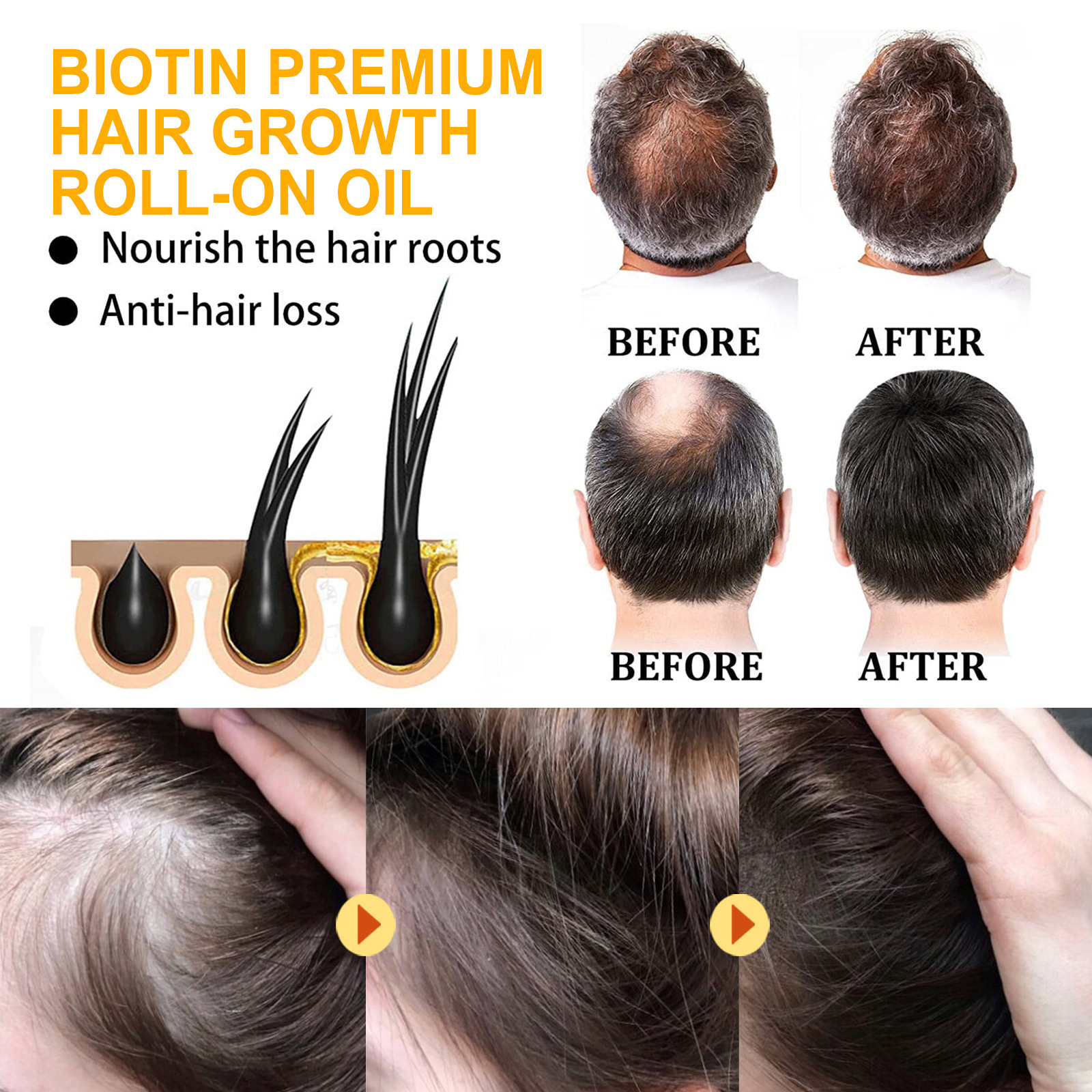 (Hair Essential Oil) EELHOE Biotin Hair Spray For Man Women Repair Damage Restore Oil Scalp Repair Serum Spray Thicken Hair Health Care Anti Hair Loss Hair Growth Treatment