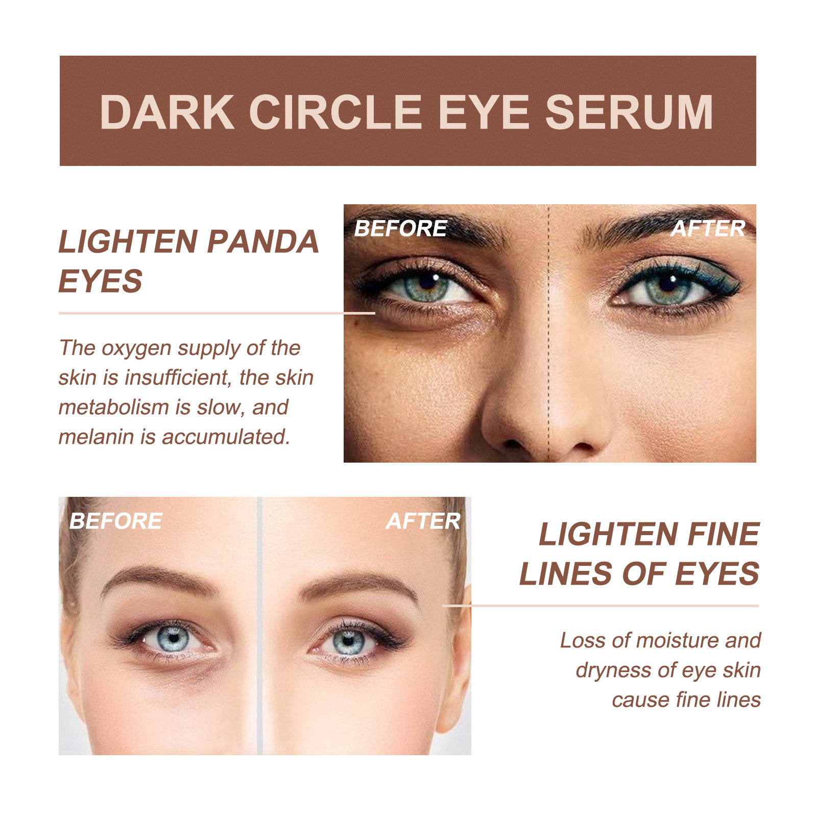 (1 PC) Dark Circles Removal Serum Light Lines Essence Under Eye Puffiness Eye Bags Remover Essence Fade Melanin Anti Wrinkle Whitening Moisturizing Eye Care