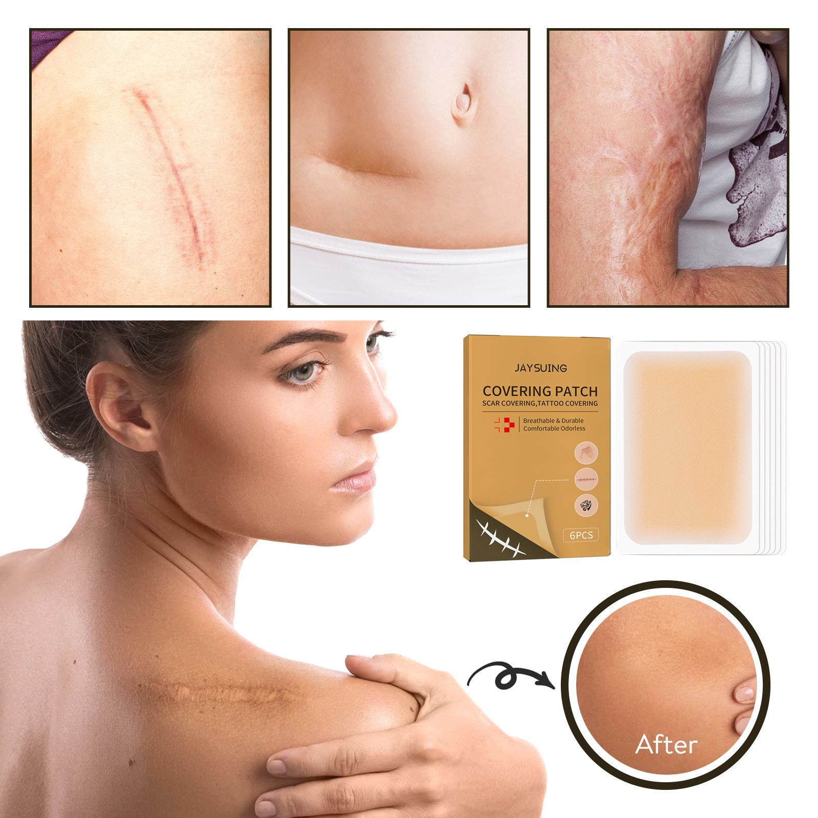Tattoo Concealer Patches Ultra Thin Patch For Tattoo Scar And Birthmarks Conceal Skin Color Invisible Waterproof Skin Tone Concealer Sticker For Covering