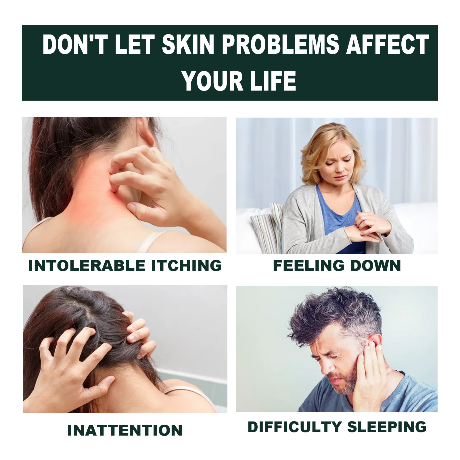 Skin Care Cream For Hands And Feet Moisturizing Hydrating And Nourishing Daily External Topical Treatment