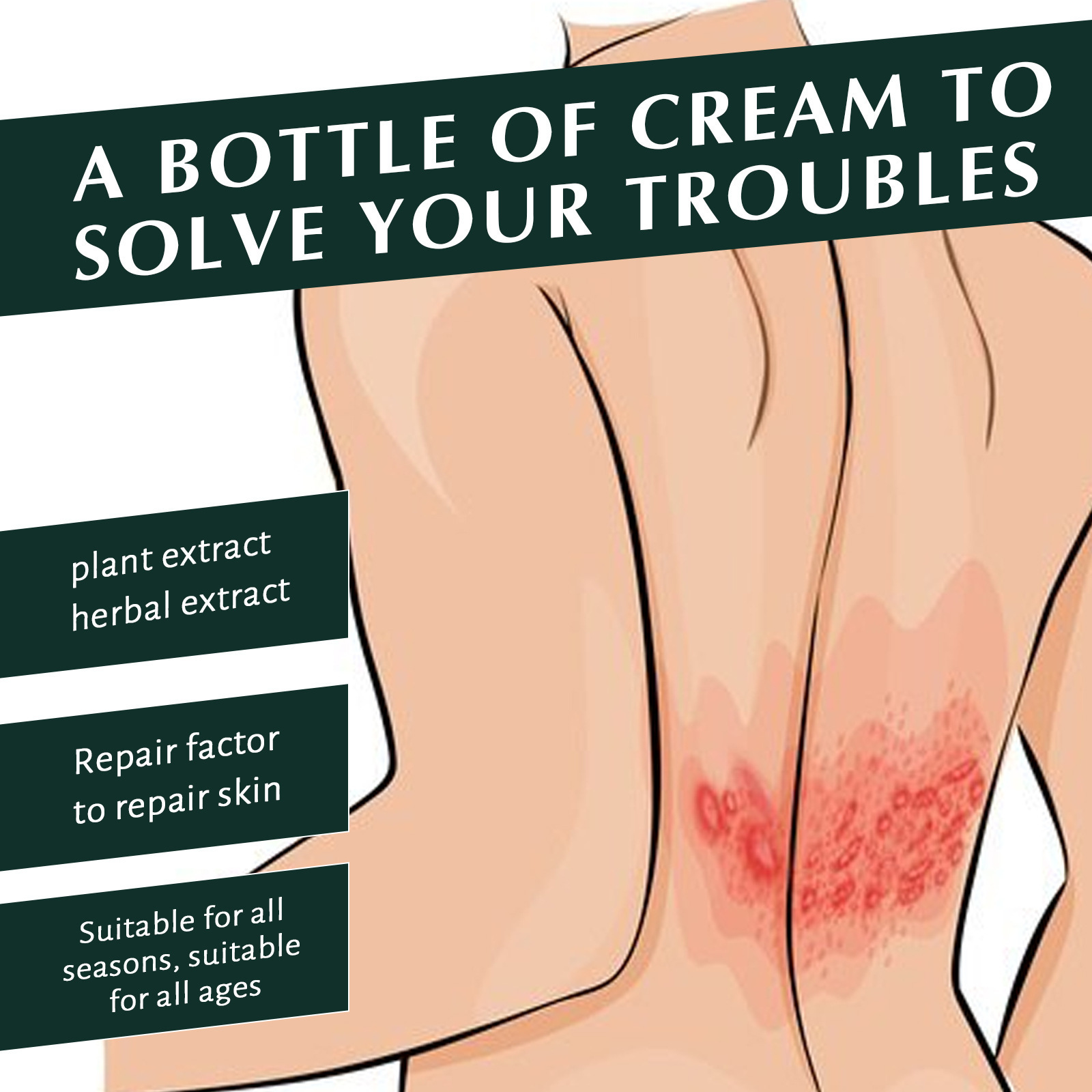 Skin Care Cream For Hands And Feet Moisturizing Hydrating And Nourishing Daily External Topical Treatment