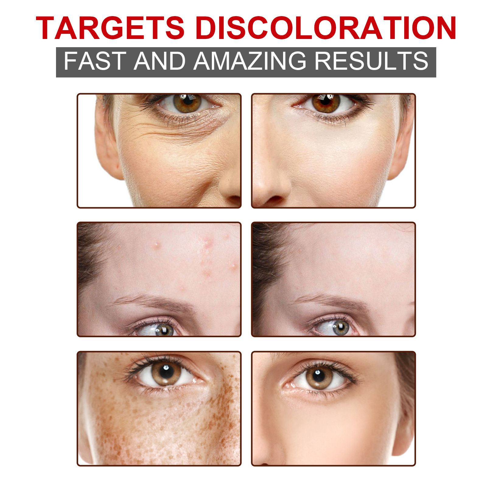 Skin Brightening Cream Moisturizing Nourishing Fade Spots Hydrating Repair Glow Bright Skin Tone Facial Care