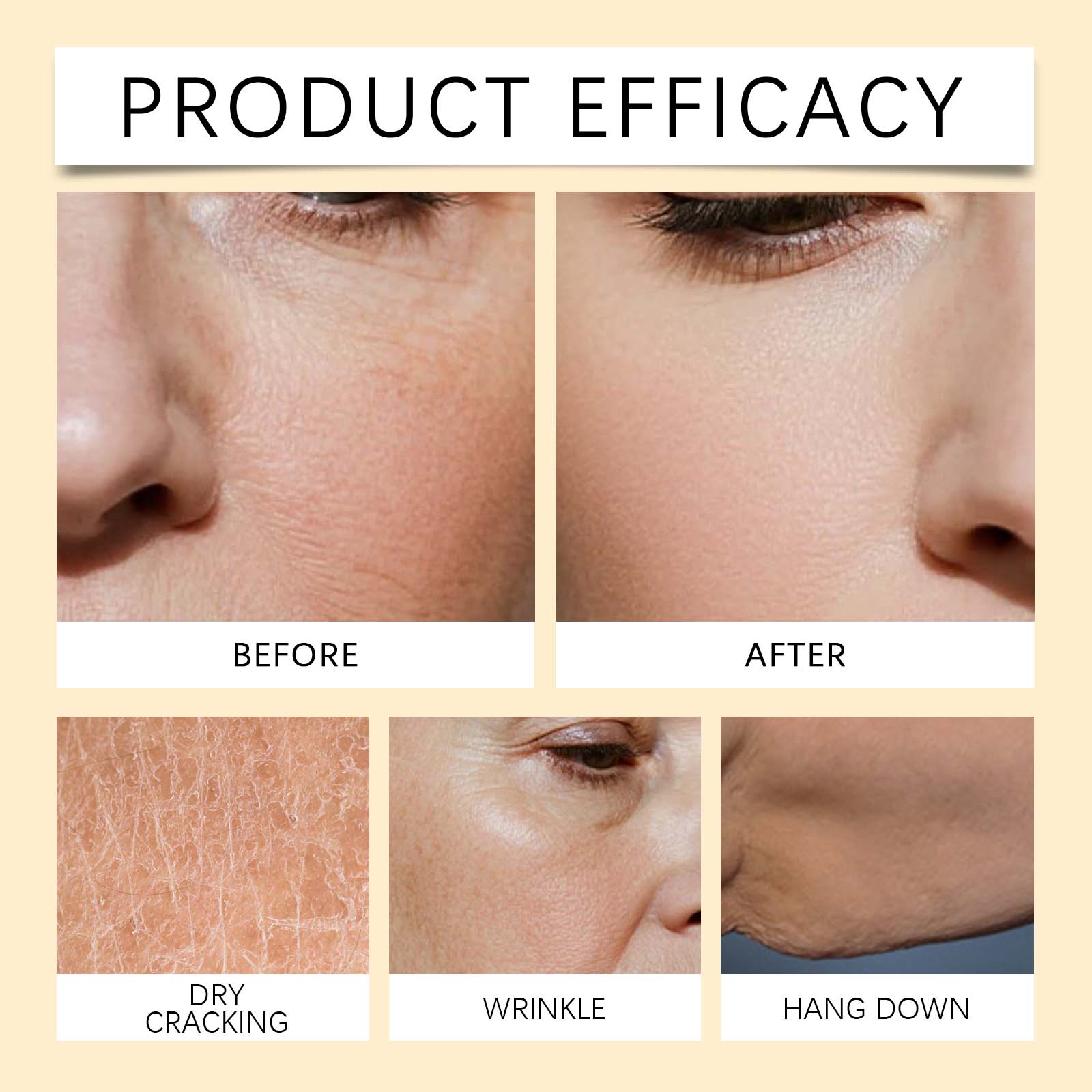 Bee Venom Skin Care Essence Daily Care Massage Body Skin Nourish Smooth Skin External Essence