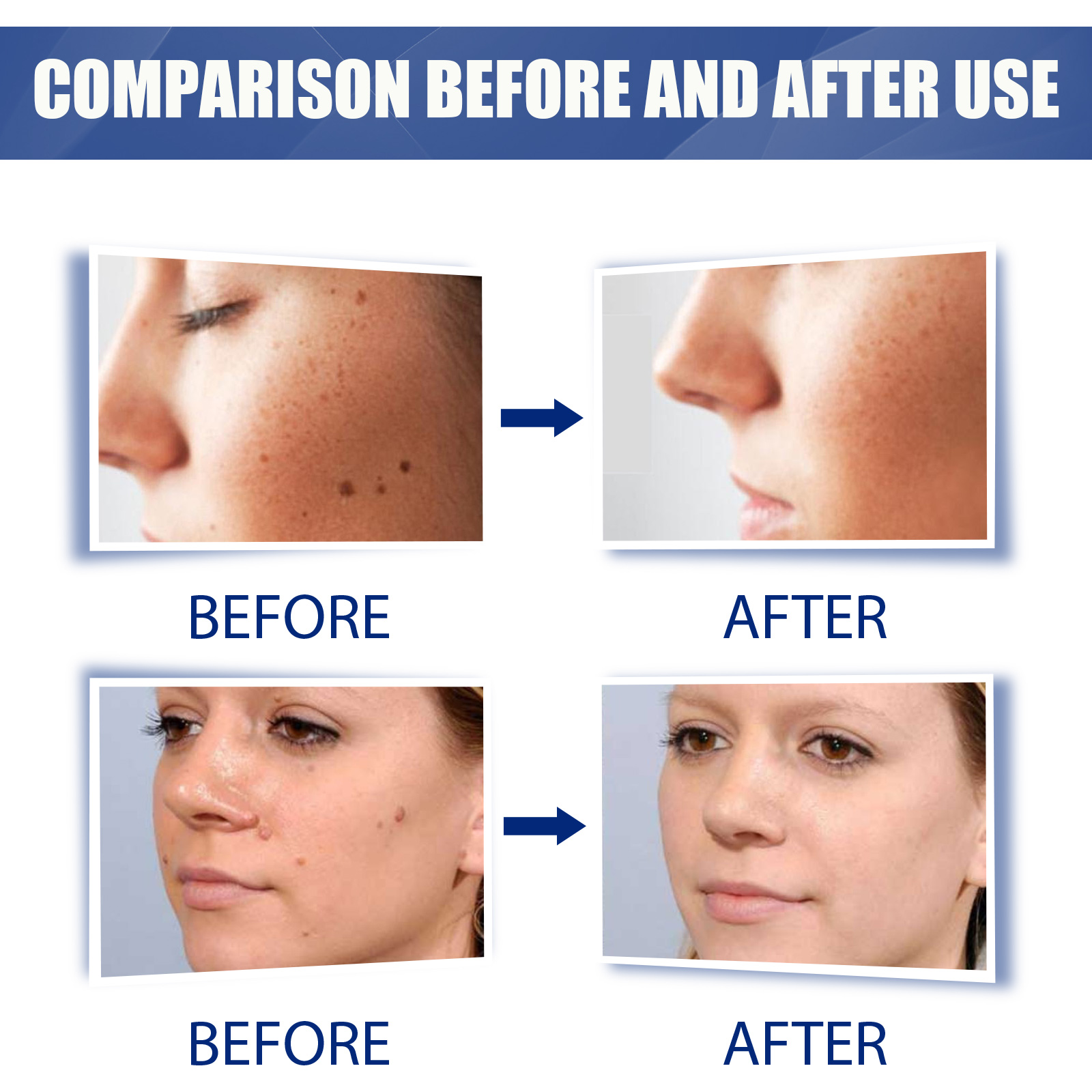 Skin Care Balm For Body Smoothing Nourishing Gentle Cleansing Daily External Skin Comfort Maintenance