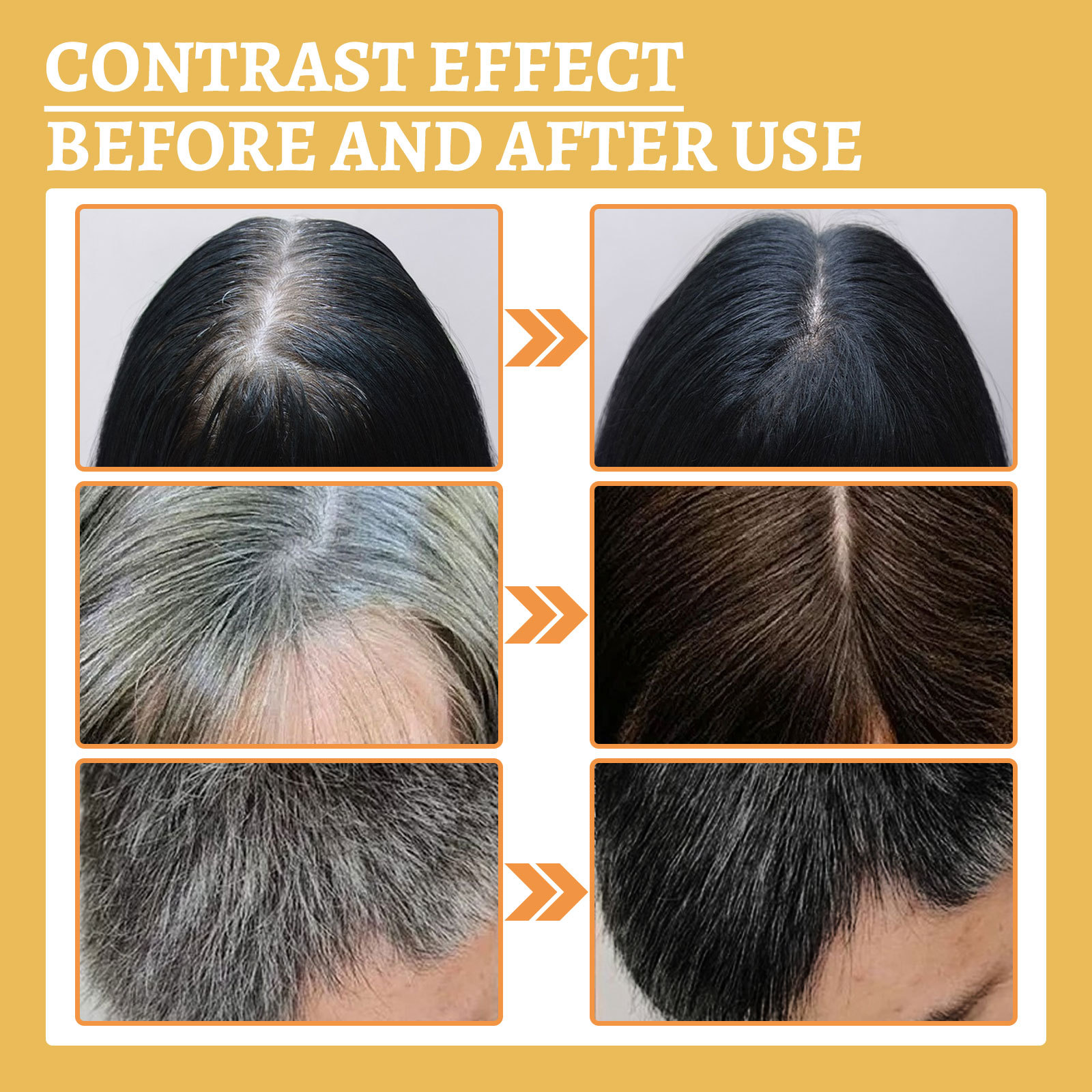 Anti-Greying Hair Serum Hair Care Serum Anti Grey Hair Supplements Ganoderma Nutrient Natural Darkening Promotes Healthier and Thicker Hair 30ml