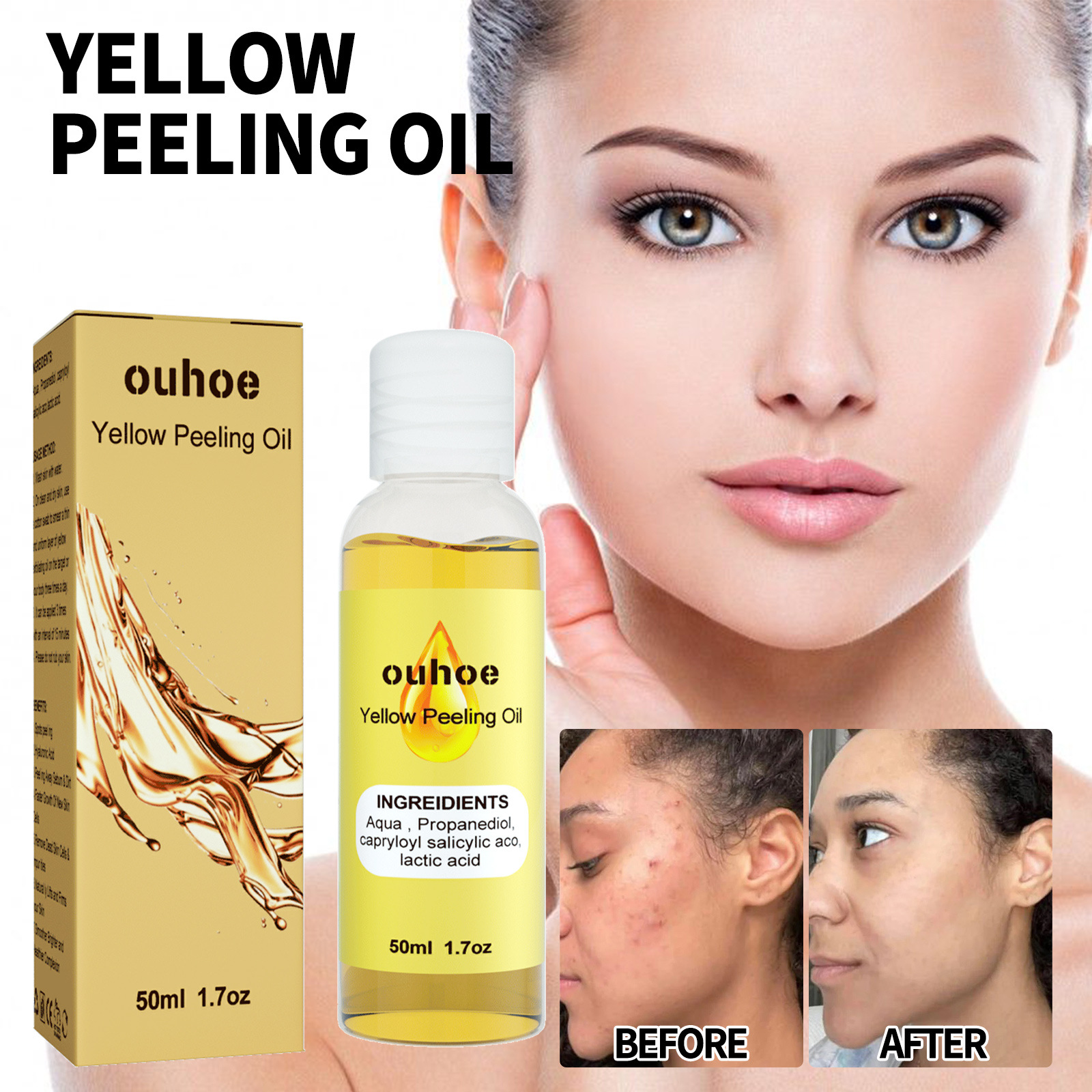 Whitening Peeling Oil for Face Natural Super Strength Yellow Peeling Solution Oil Body Exfoliation Dark Skin Remove Brightening Whitening Skin Care