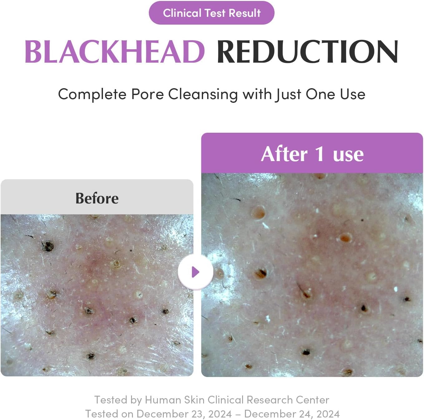 EQQUALBERRY Purple Rice Pore Purifying Cleanser Dual-Use Clay Mask Foam Cleanser Deep Cleansing Pore Care Skin Prep AHA BHA PHA Korean SkincareGlass Skin 130g