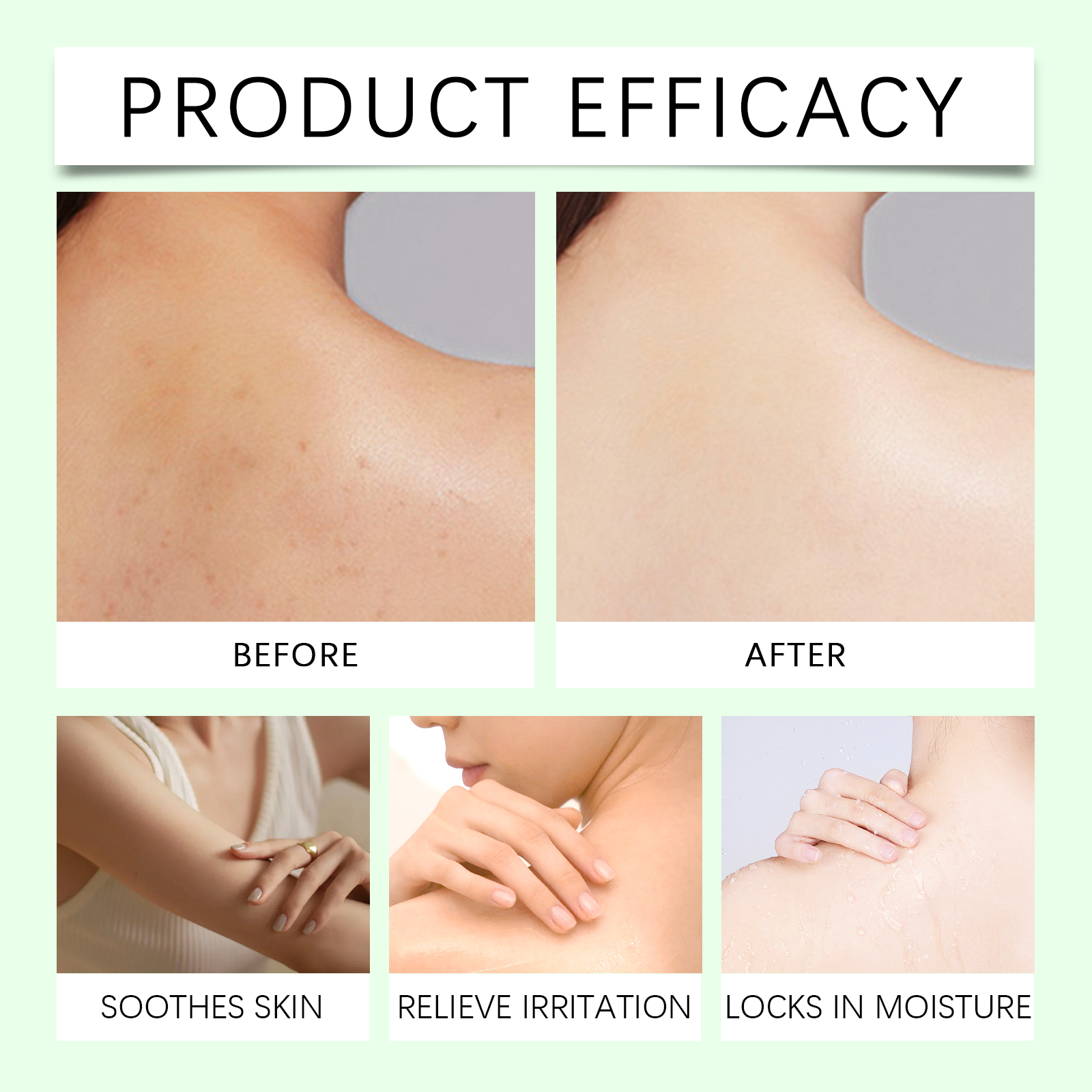 Skin Care Mist Clean Refreshing Comfortable Moisturizing Portable Acne Closed Comedo Skin Care Treatment