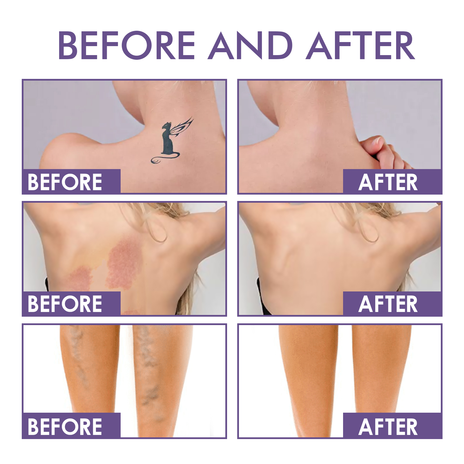 Body Concealer Cream Waterproof Camouflage For Tattoos Scars Birthmarks Veins And Uneven Skin Tone Daily Coverage