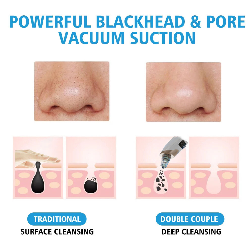 Blackhead Remover Vacuum Facial Pore Cleaner Household Electric Acne Comedone Whitehead Extractor Tool LCD Display Skin Car Device  For Women And Men