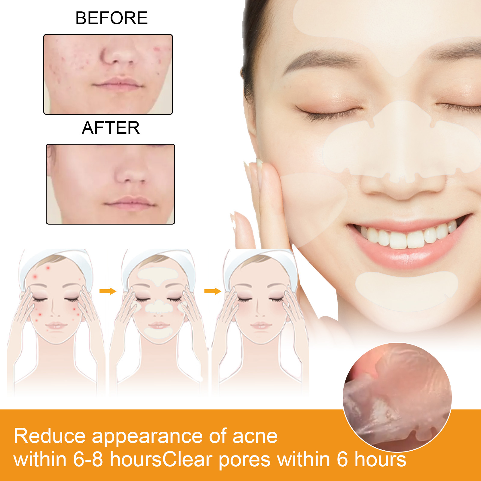 EELHOE Hydrocolloid Face Patche Oily Conbination Skin