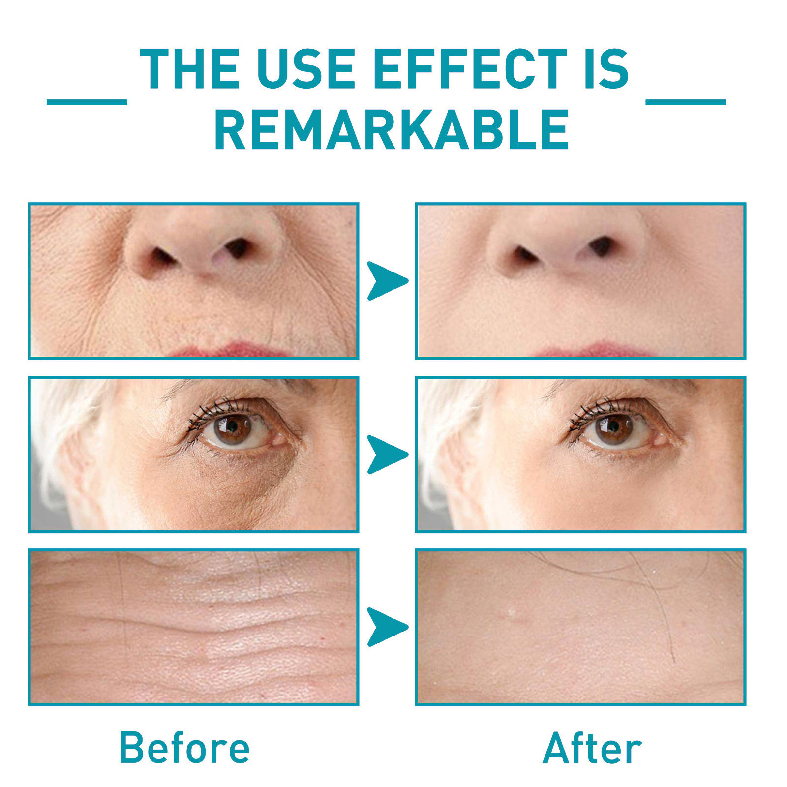 (1 PC) Anti Wrinkle Serum Hexapeptide Cono Peptide Essence for Face Lift Firming Improve Rough Sagging Tightening Fade Forehead Lines Age Spots Removal
