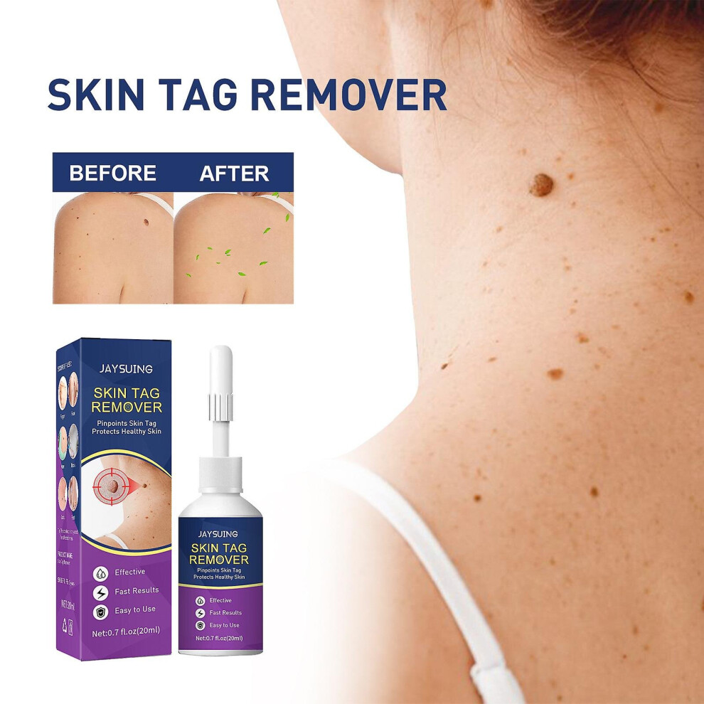 Skin Tag Remover   Skin Tag Remover Serum  From
