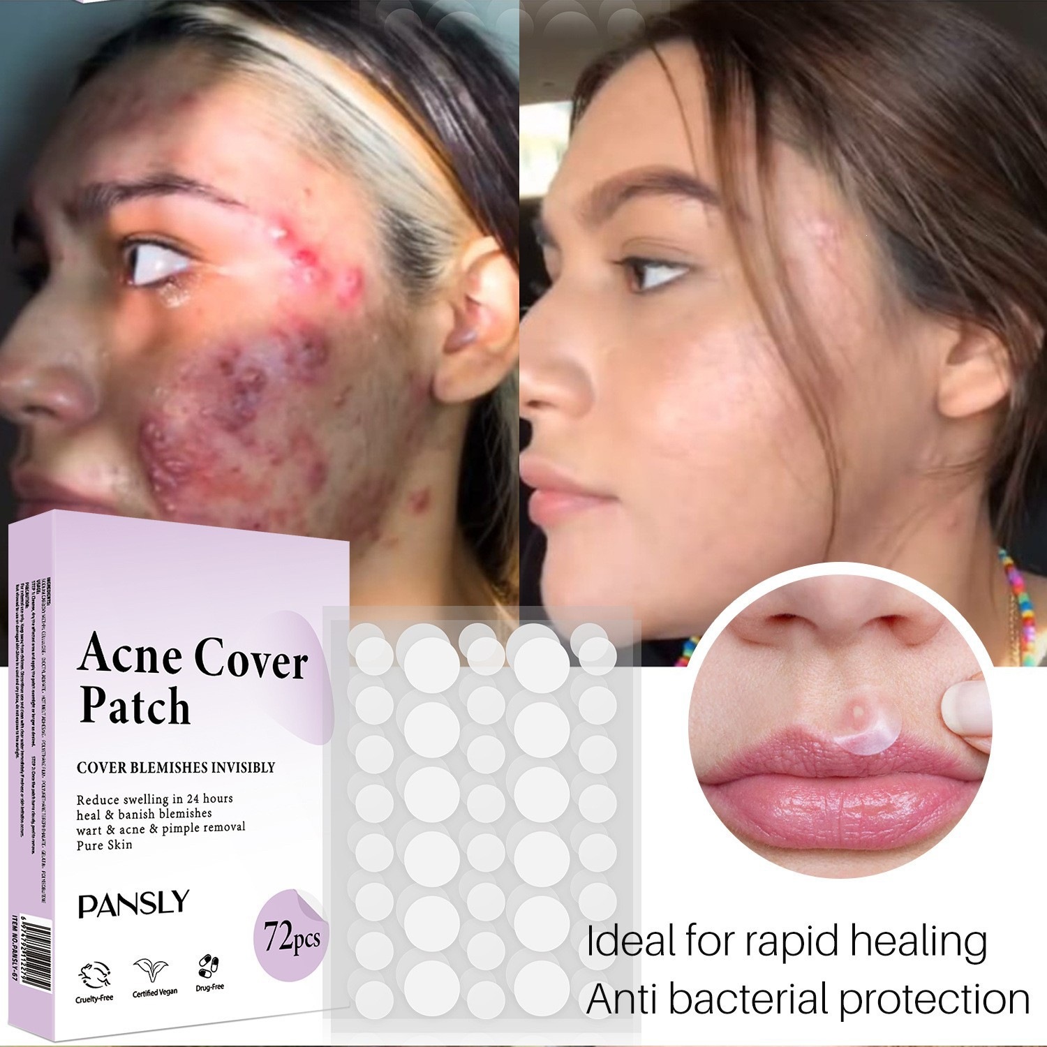 Invisible Acne Patch Hydrocolloid Blemish Spot Cover for Pimples Blackheads Zit Removal Daily Skin Care Natural