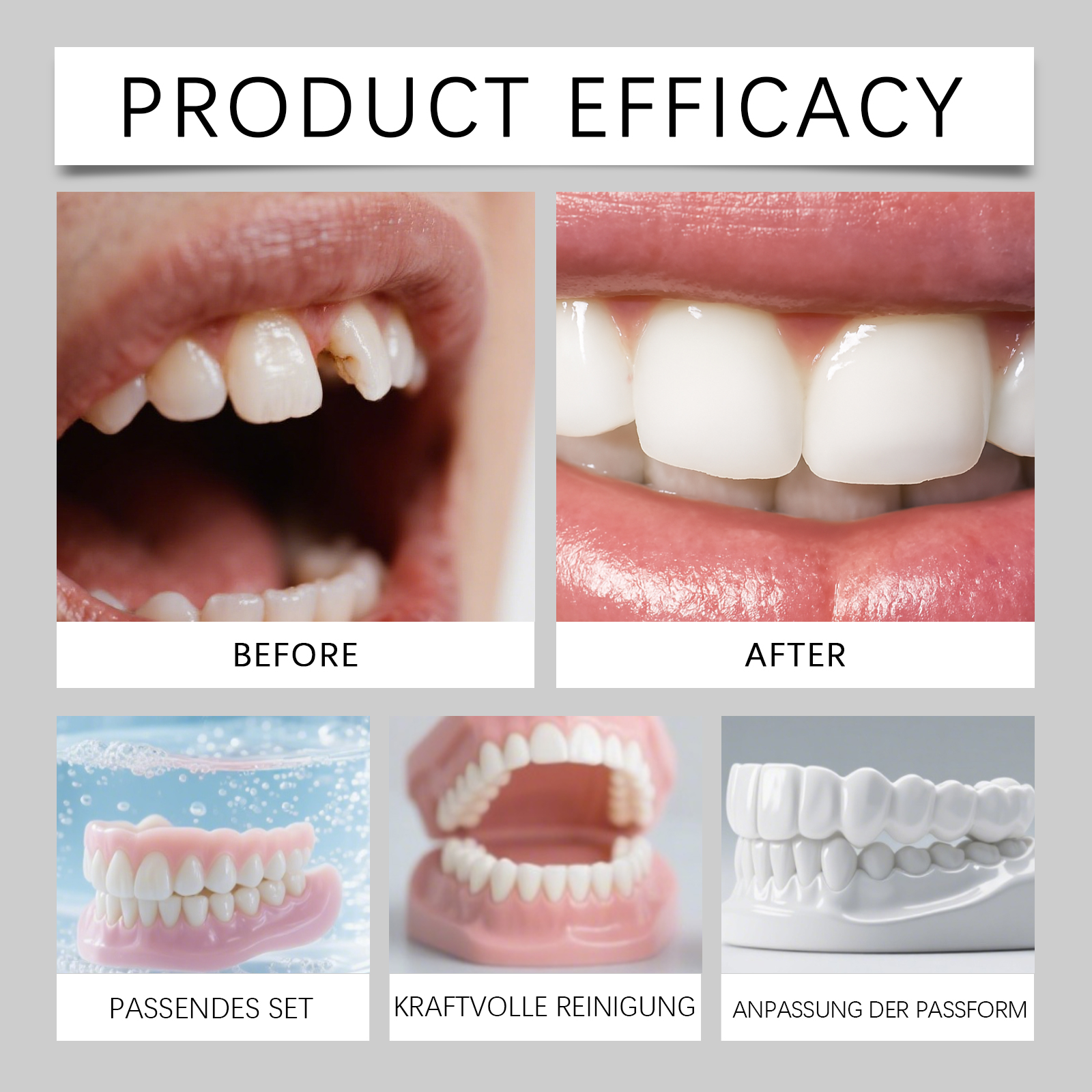 Denture Modifying Kit Comfortable Material Stable Wearing Easy Operation Convenient Improve Aesthetics Daily Care Set