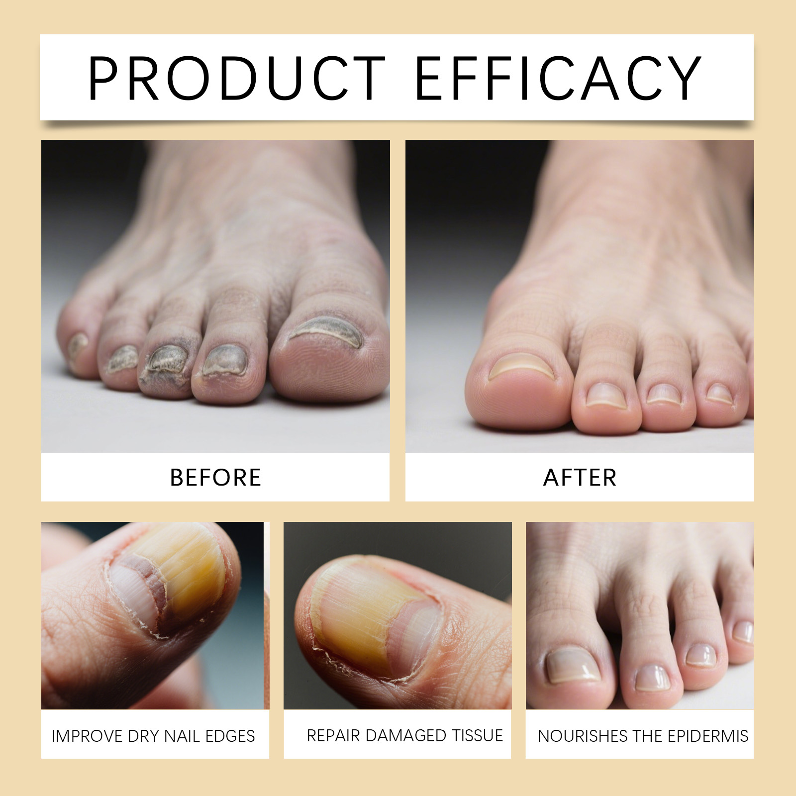 Nail Care Liquid Nourish Moisturize Brighten Harden Mild Clean Comfort Maintain For Finger Nail