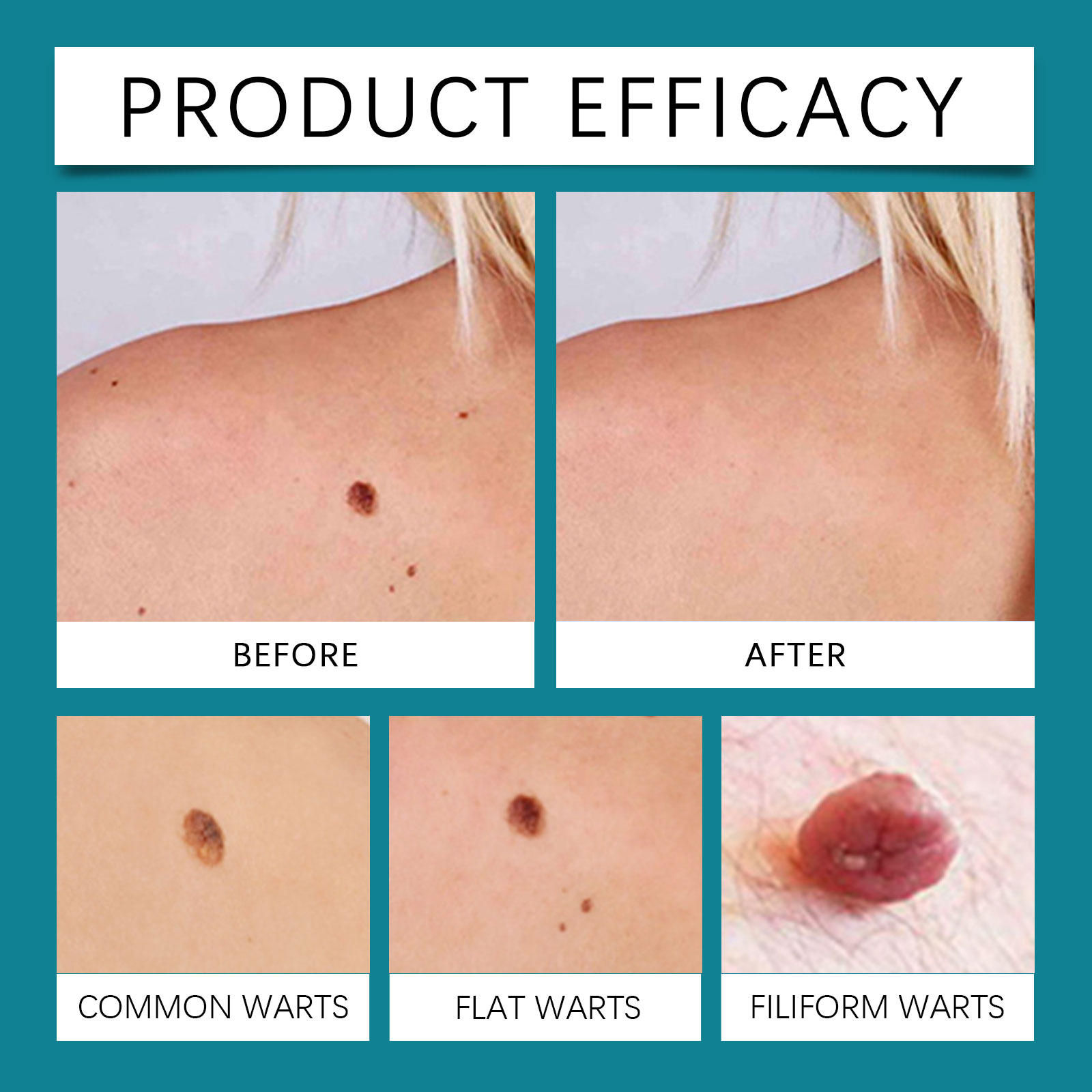 Body Care Patch Mild Care Moist Hydrate Soft Breathable Skin Friendly Convenient Daily Body Skin Nursing