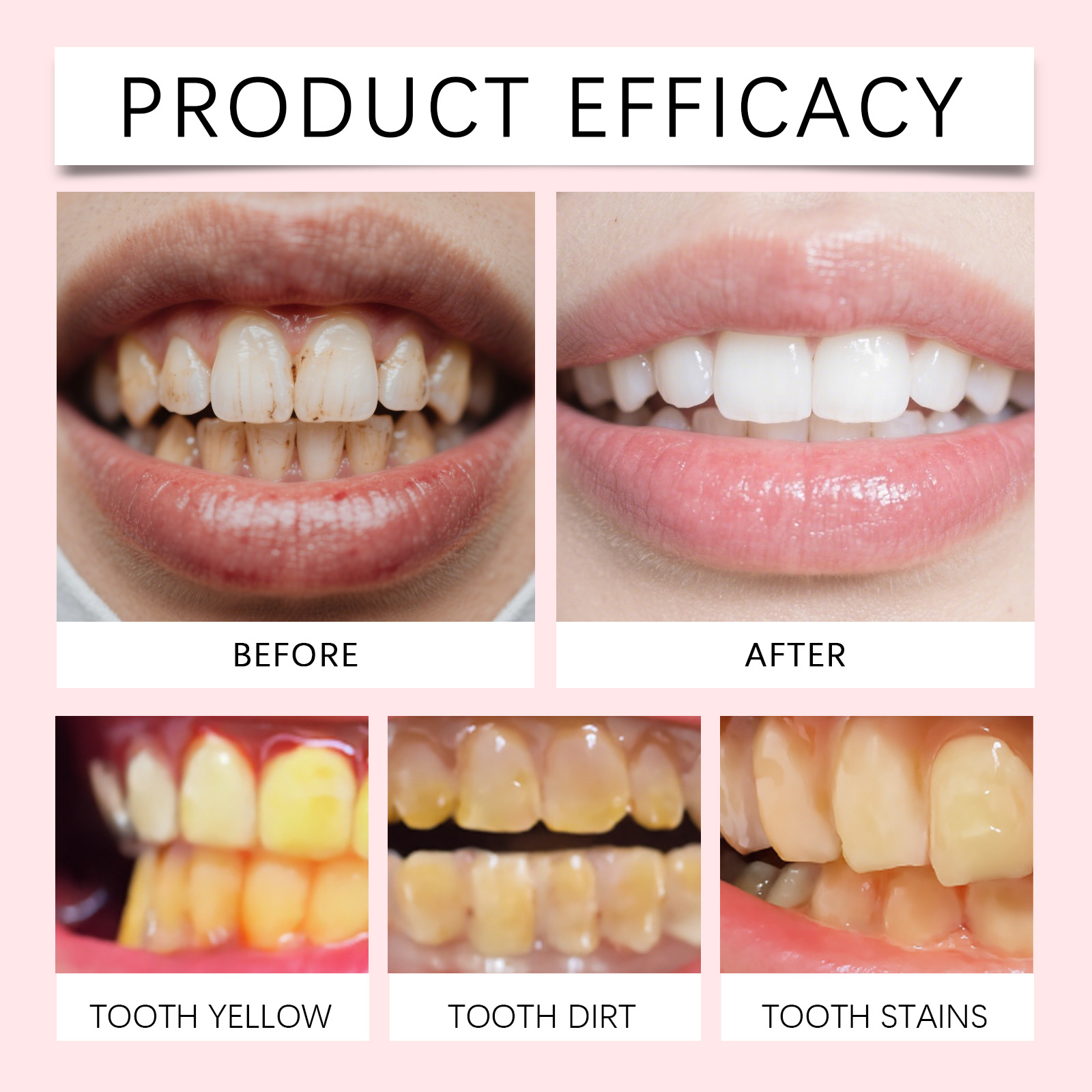 Toothpaste Daily Cleans Teeth Oral Residues Freshens Breath Protects Teeth Bright Mild Comfortable