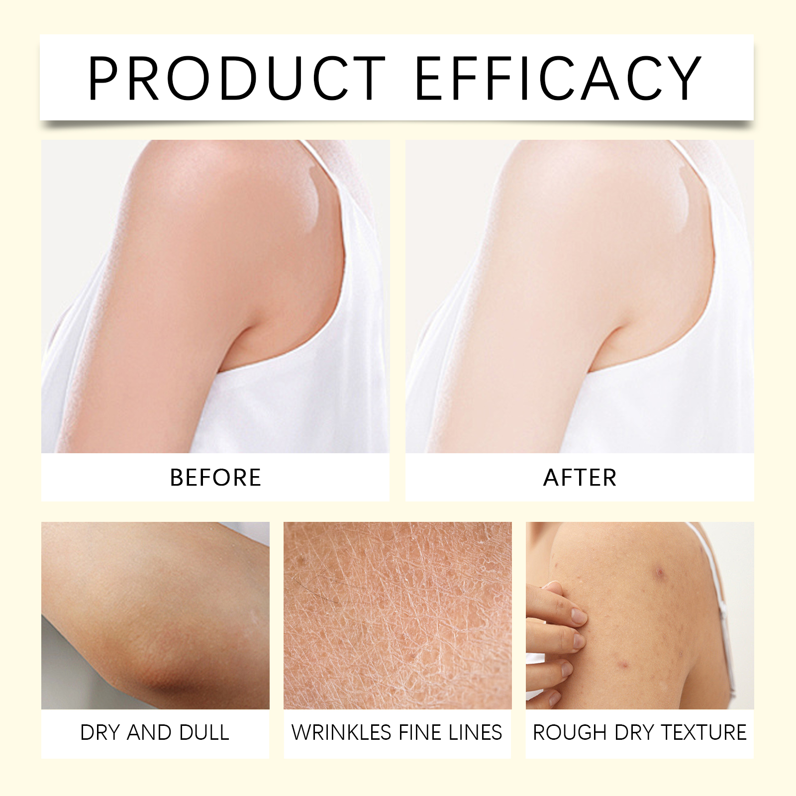 Herbal Skin Moisturizing Cream For Irritated Dry Skin Protect Skin Barrier Care Complexion