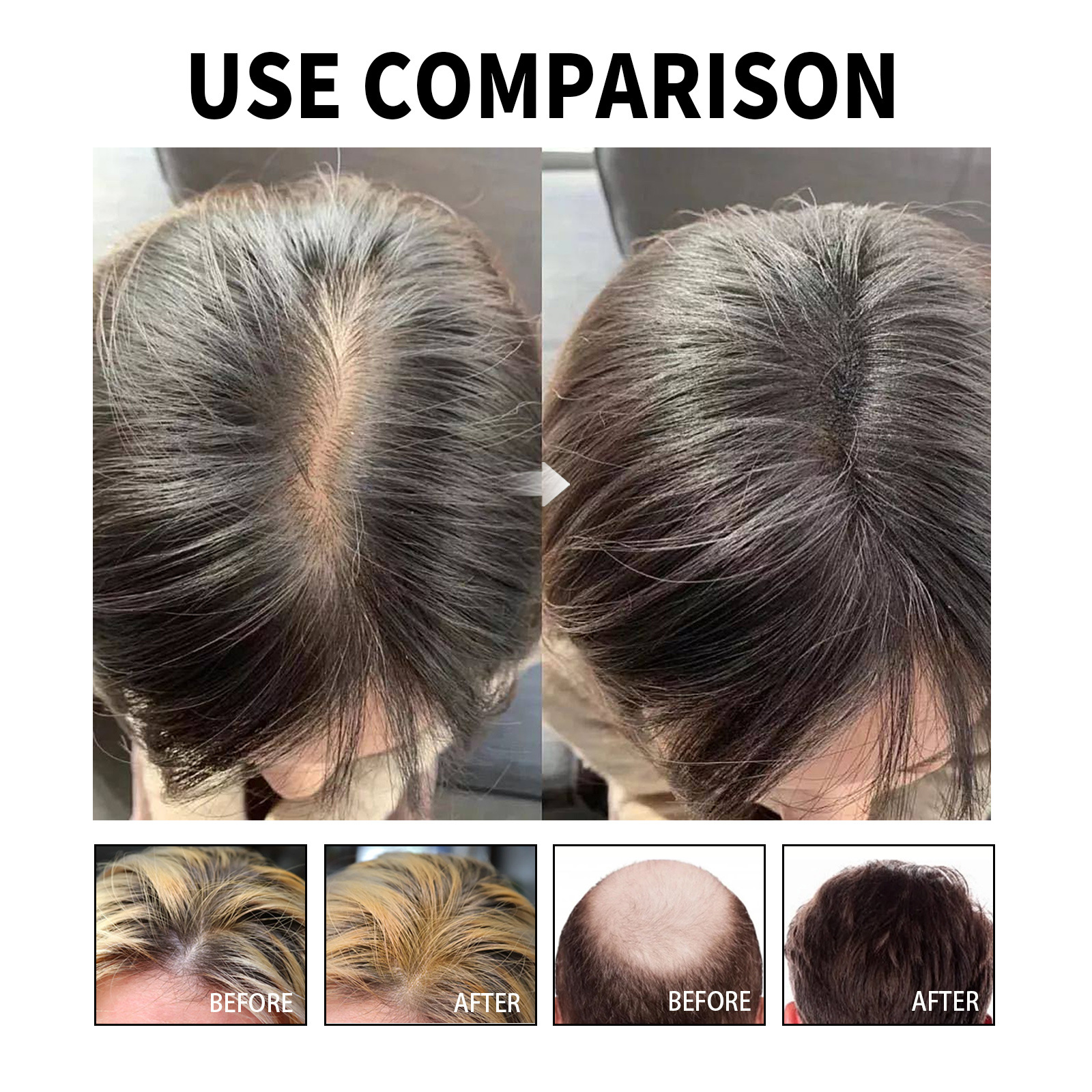 Hair Nourishing Treatment Strengthening Serum  Anti Hair Loss Essence Scalp Care Hair Treatment Oil for All Hair Types 60ml