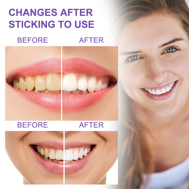 Teeth Whiteners Teeth Whitening Mousse Toothpaste Yellow Teeth Cleaning Removing Bad Breath Stain Oral Keep Fresh Tooth Whitening Care Product 30ml