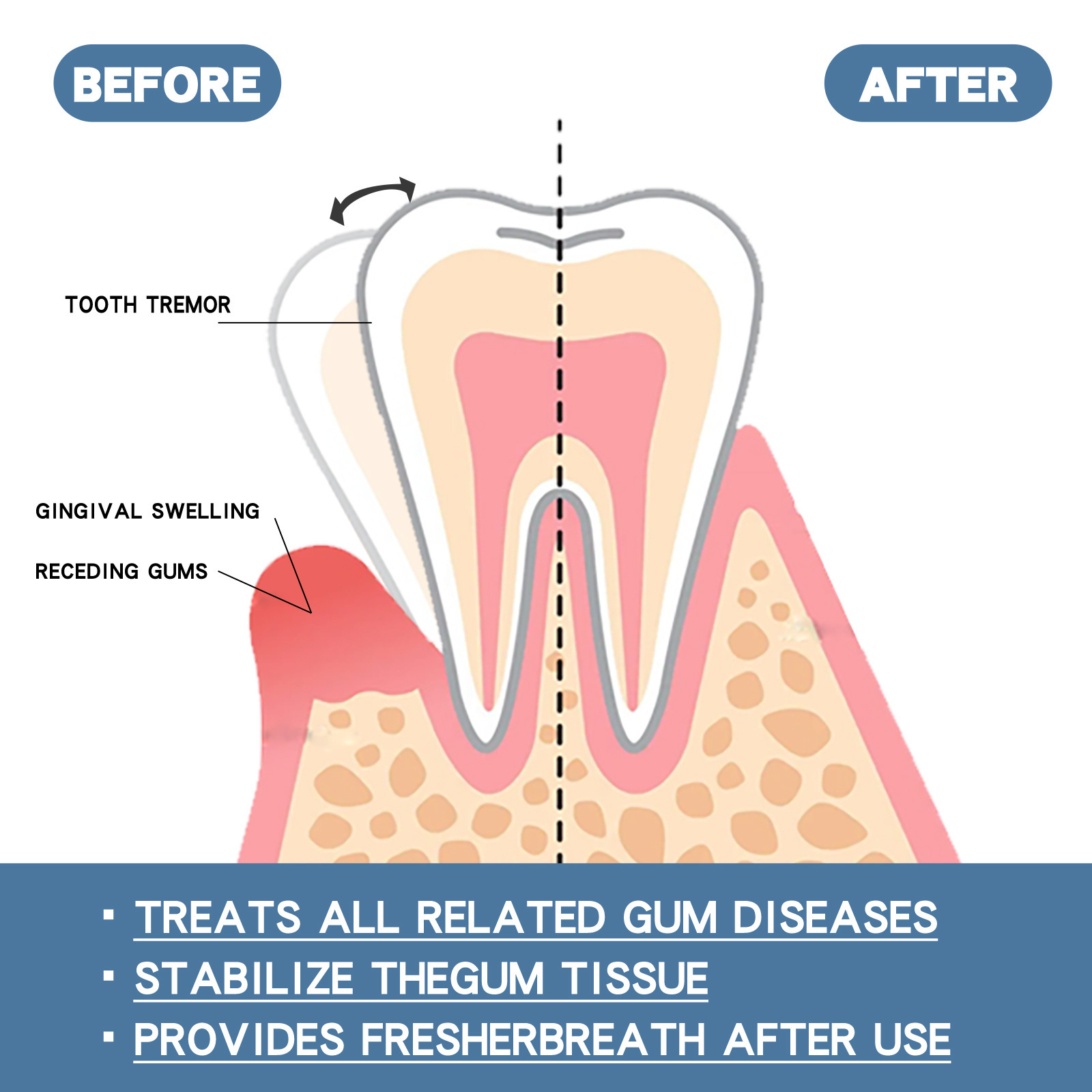 EELHOE Natural Gum Repair Drops Mouth Periodontal Relieve Teeth Whitening Oral Treatment Gum Care Gingival Growth Liquid Product Teeth Whiteners