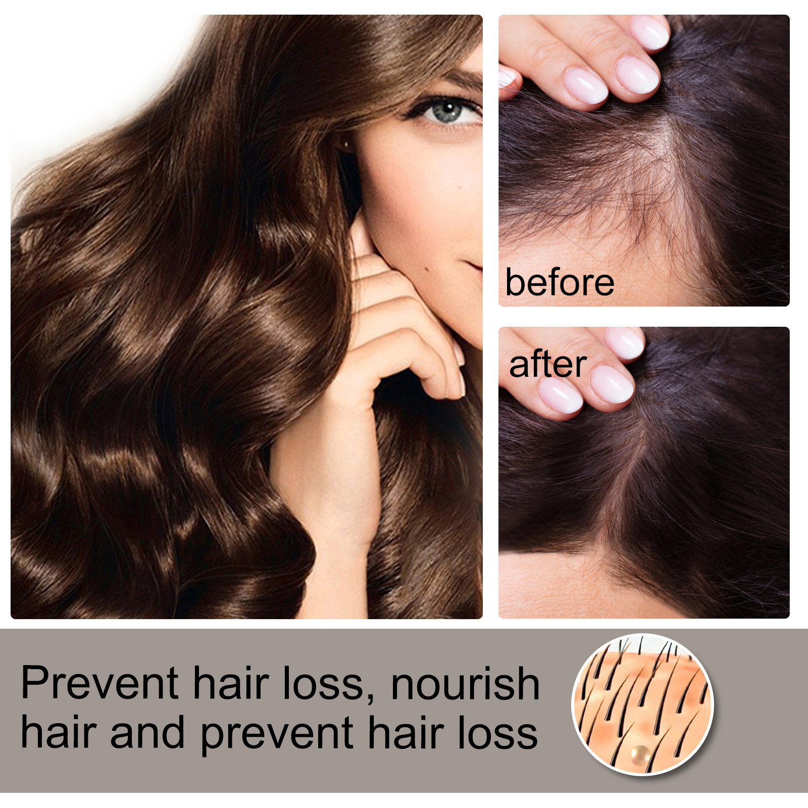 Hair Growth Essential Oil Essence Original Authentic Prevent Hair Loss Liquid Care Beauty Hair Growth Spray Hair Care Serum 30ml