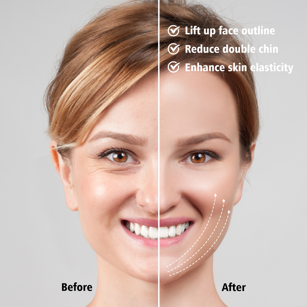 (White) LED Photon Therapy Facial Mask Massager Facial Lifting Device Double Chin V Face Shaped Cheek Lift Belt Machine for Men and Women Training