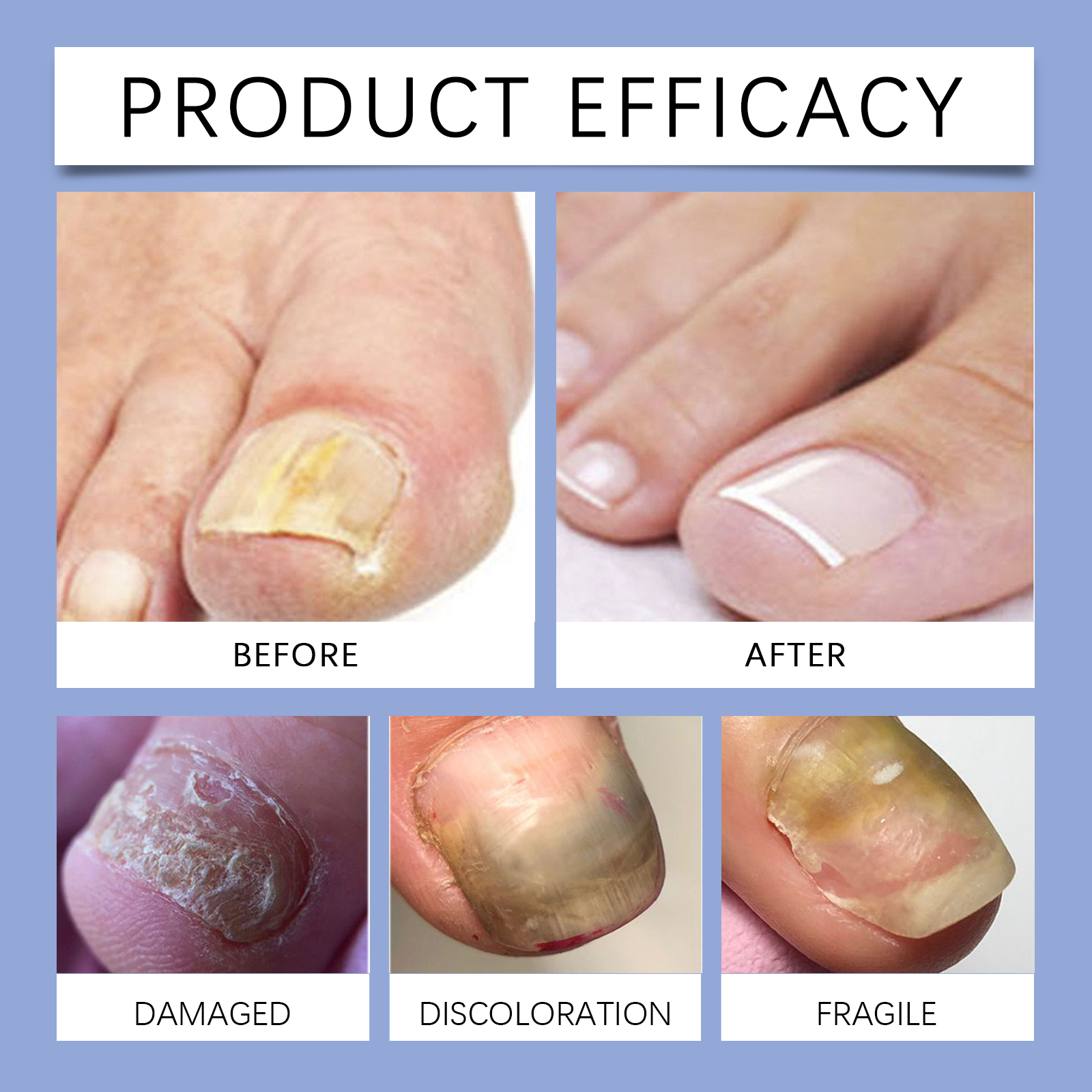 Nail Care Liquid Surface Cleansing Moisturizing Gentle Maintenance For Hand And Foot Nails