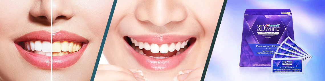The Most Popular Teeth Whiteners Products