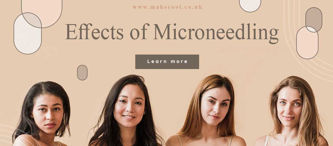 Effects of Microneedling