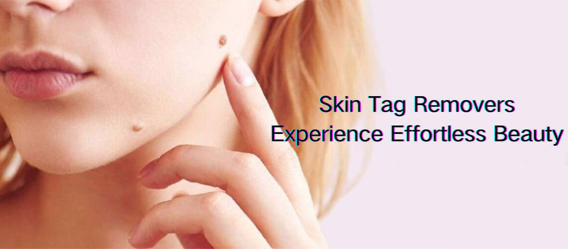 Safe & Effective Skin Tag Removal Solutions