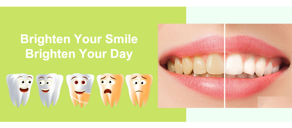 The Best Home Teeth Whitening Choice